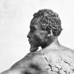 An aged photograph of a Black man baring his scarred back.