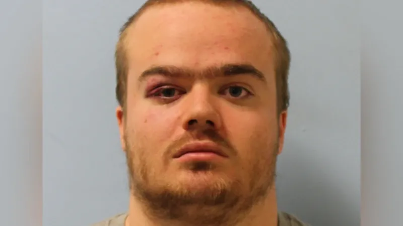 A man with a black eye looks at the camera.